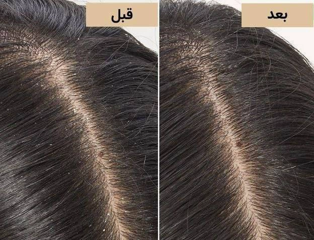 اسکراب کف سر بیوتین و کافئین TWG اصلی